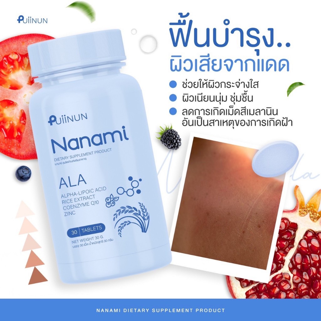 Slot Nexobet ศูนย์รวมเกมสล็อตคุณภาพ ระบบทันสมัย เว็บตรงแน่นอน